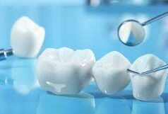The Future of Dental Implants: Trends and Projections Dental Implants