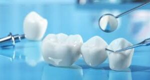 The Future of Dental Implants: Trends and Projections Dental Implants